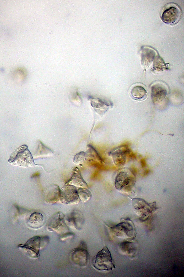 Due ciliati: Vorticella e .....